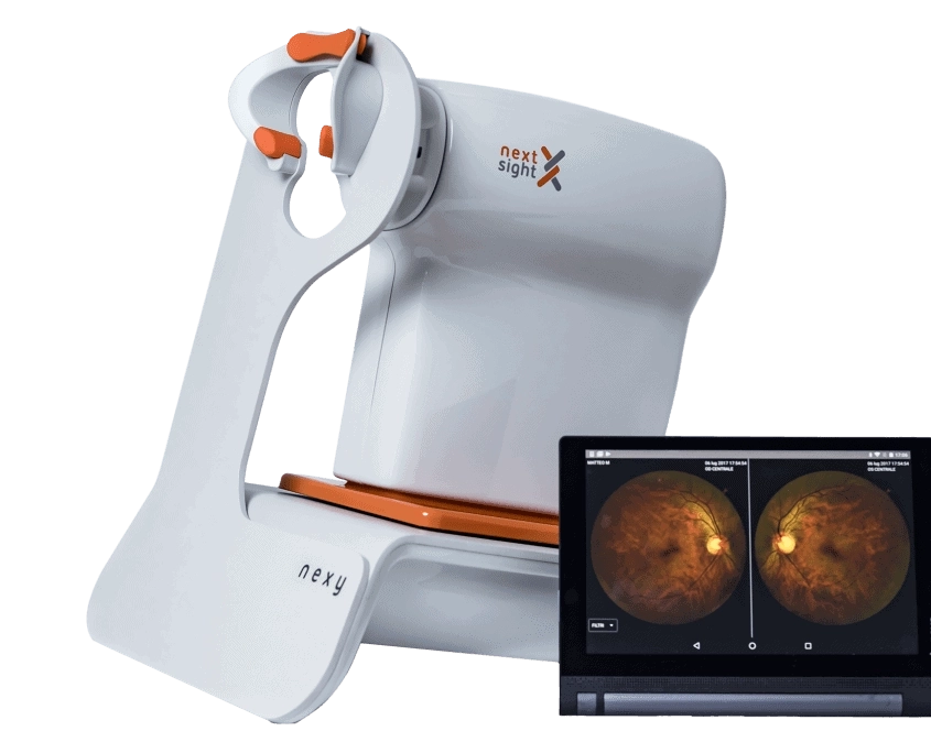 NEXY NEXTSIGHT